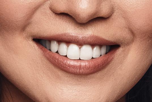 Emergency Dental Services