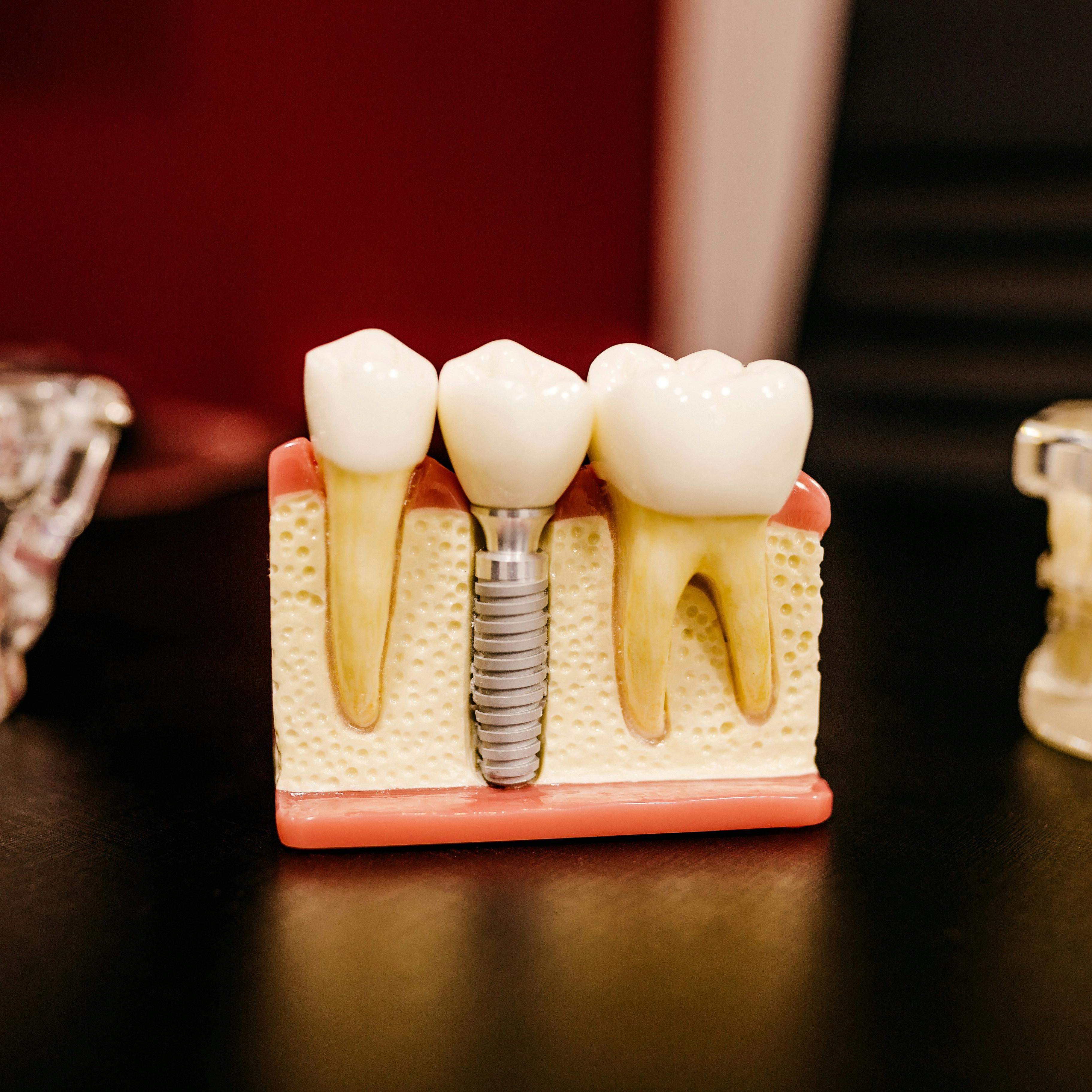 Tooth