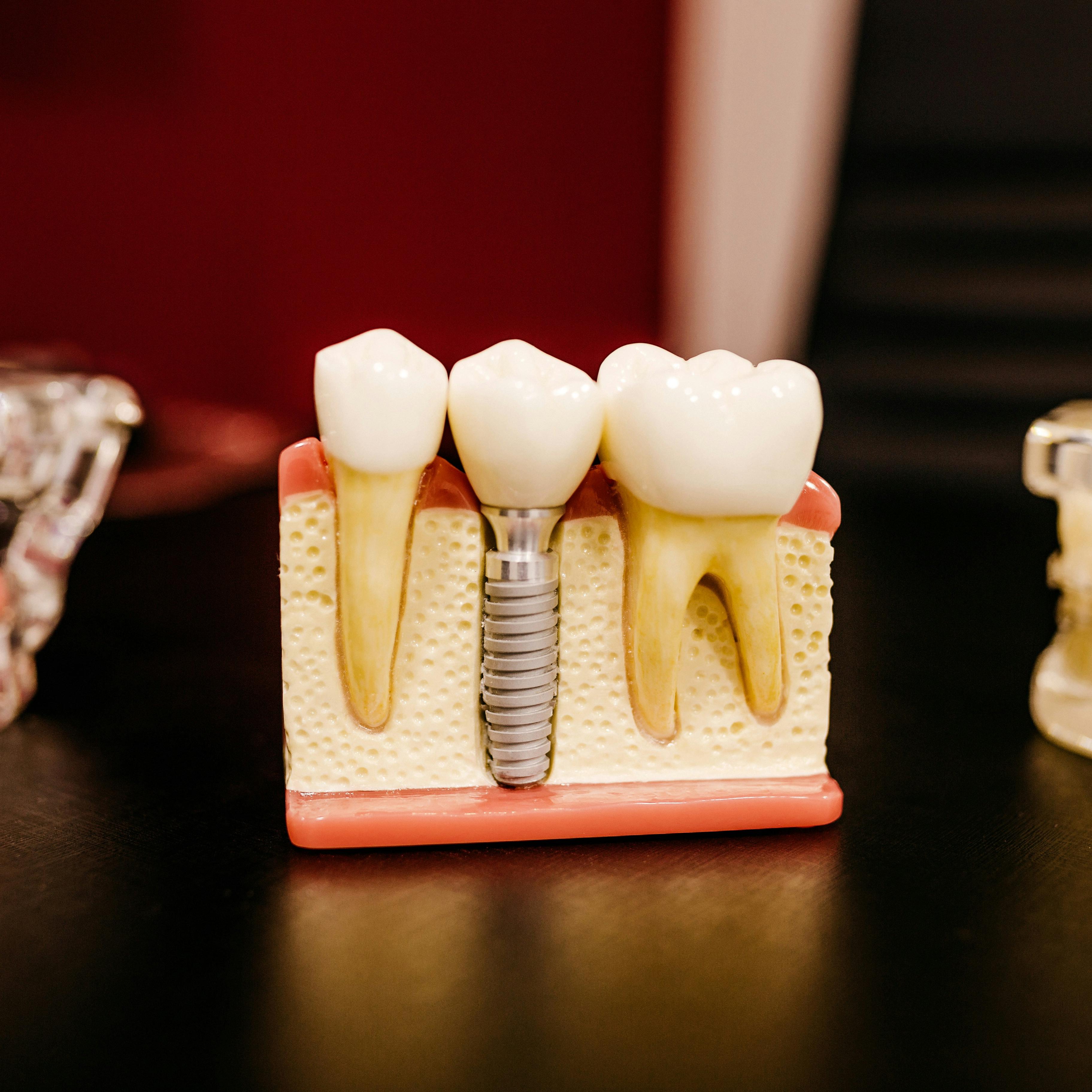 Tooth
